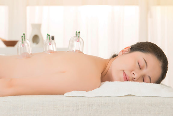 Cupping - Essence Acupuncture & Wellness - Traditional Chinese Medicine Healthcare