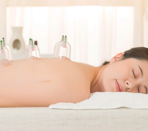 Cupping - Essence Acupuncture & Wellness - Traditional Chinese Medicine Healthcare