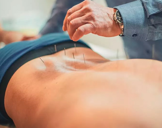 Acupuncture and Low Back Pain - Texas MedClinic Careers