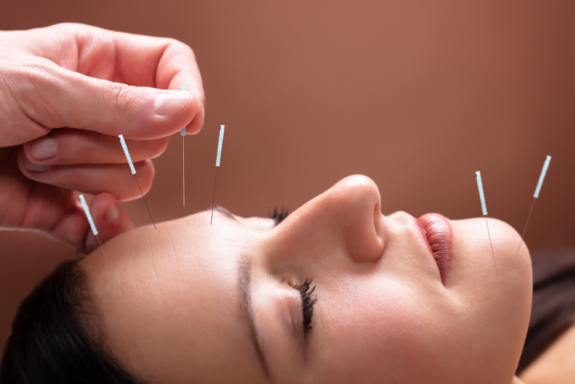 Exploring Facial Rejuvenation Acupuncture and Its Holistic Benefits - Essence Acupuncture Wellness - East Asian Medicine Healthcare